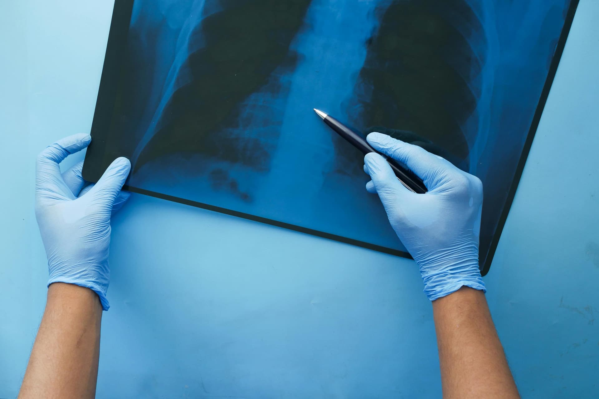 Pneumologia