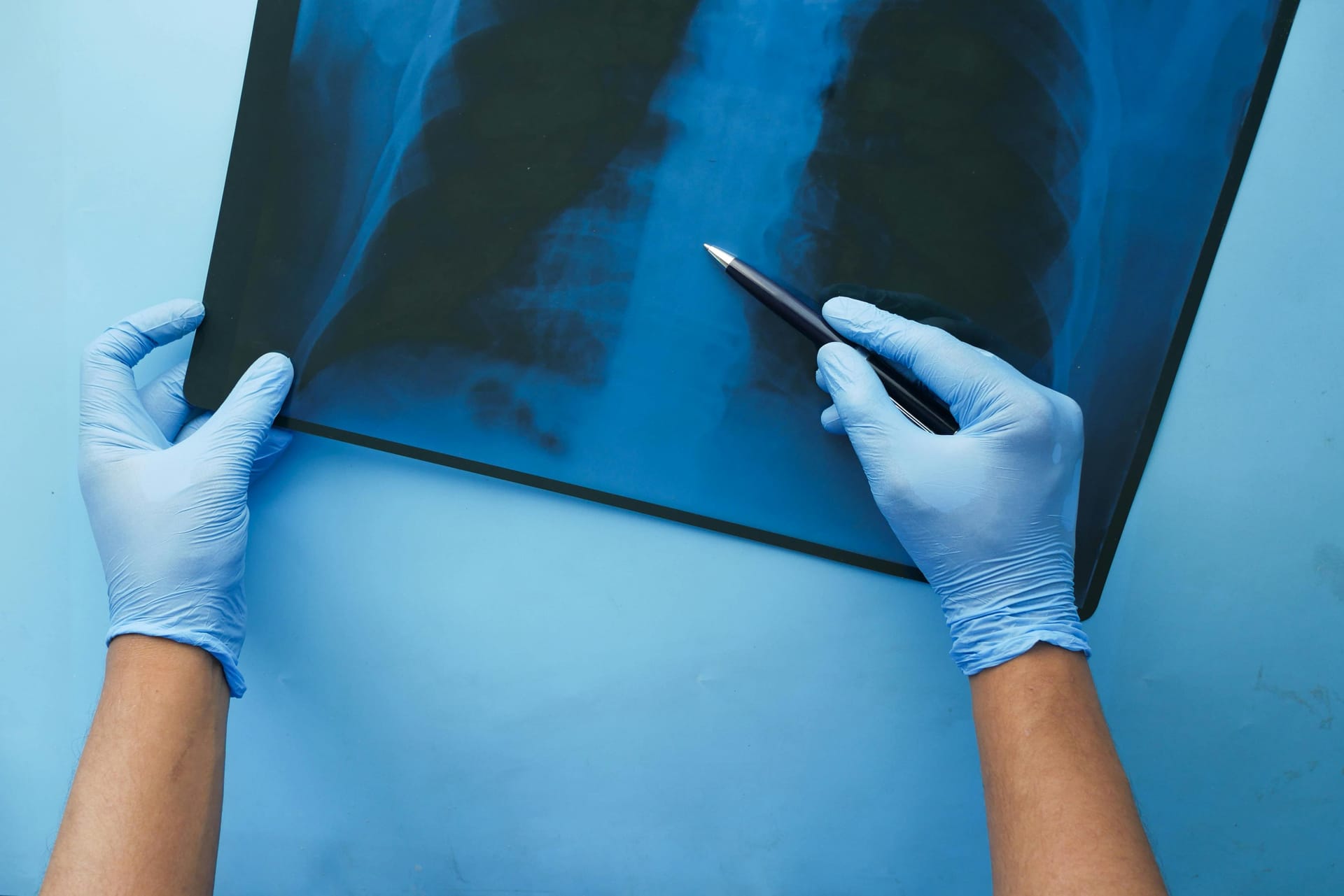 Pneumologia